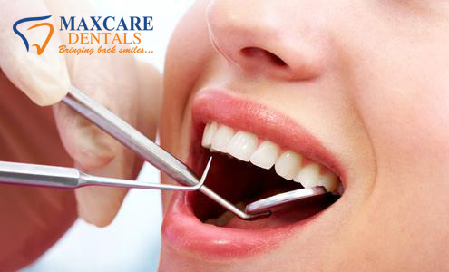 TeethCleaning